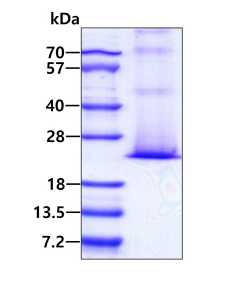 3 μg by SDS-PAGE under reducing condition and visualized by coomassie blue stain.